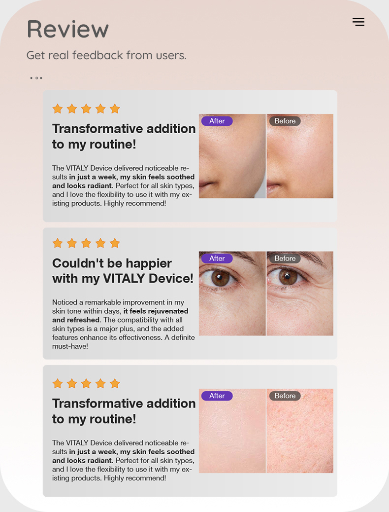 VITALY 3-in-1 Facial Massager Beauty Device-9